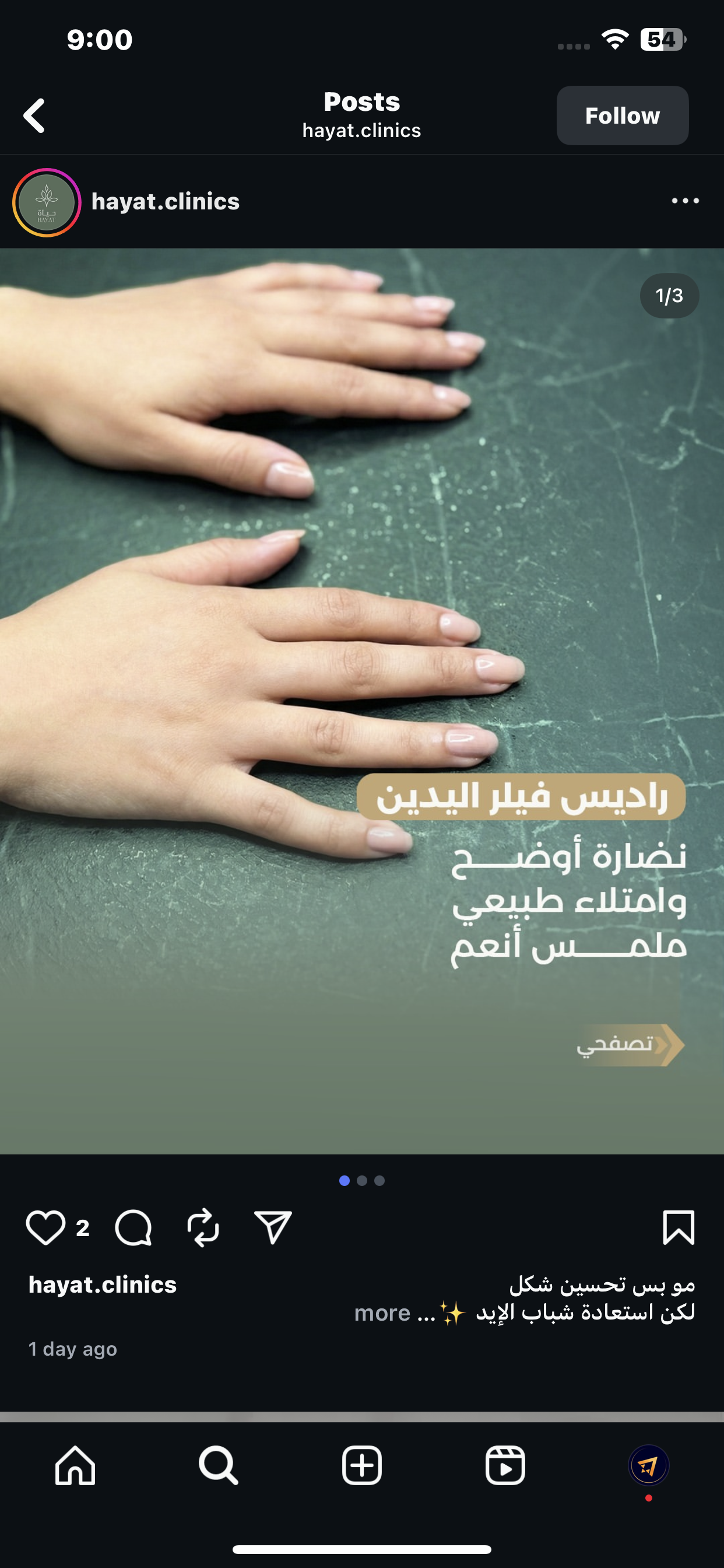 فيلر اليدين بالراديس - عيادات حياة الرياض